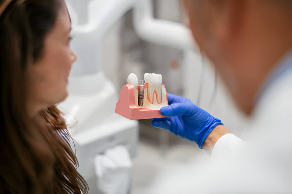 How Many Dental Implants Can Be Done at Once?